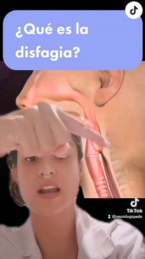 ¿Qué es la disfagia? - Explicación detallada y causas