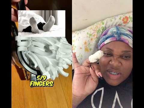 Put a finger down (broken finger edition) #putafingerdownchallenge