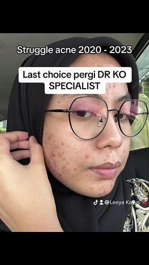 Struggle with Acne 2020 - 2023: DR KO SPECIALIST Results