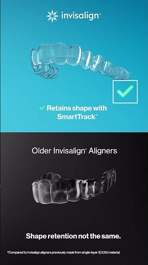 Shape retention with Invisalign
