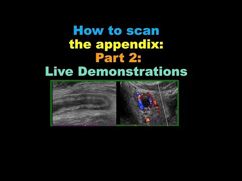 art 2: How to Scan the Appendix – Live Demonstrations
