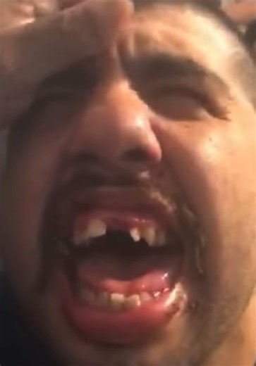 Understanding Toothache Pain and Its Impact