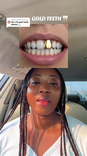 How to Fix Gold Teeth for Better Oral Health