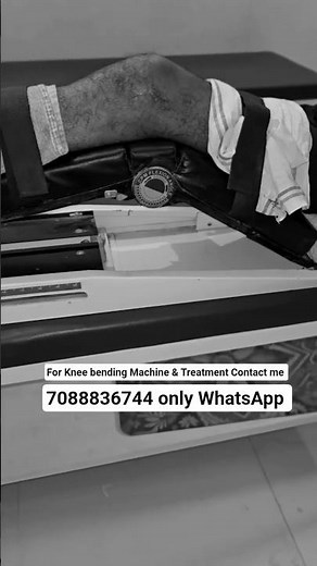 cpm machine after knee surgery, knee bending exercises after surgery, acl ligament rehab