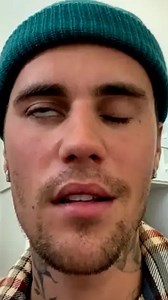 Justin Bieber's Health Crisis: Lyme Disease & Facial Paralysis #justinbieber | Beyond The Screen