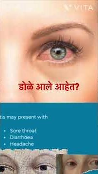 The BEST Way To Treat Conjunctivitis In 24 Hours