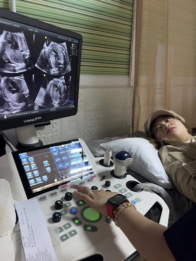 Paano po ba kami magexplain ng Congenital Anomaly Scan? 🩷 #4dultrasound #docaiddiagnosticcenter #bestremembrance #bestultrasound #bestultrasound #Obsonologist #3D4DUltrasound #CongenitalAnomalyScan #docaid #firstimemom #