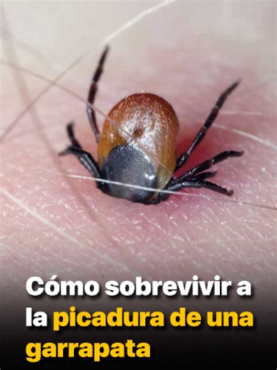 Cómo sobrevivir a la picadura de una garrapata | @soyfelipeoficial