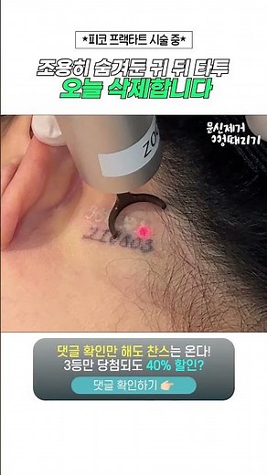 조용히 숨겨둔 귀 뒤 타투 오늘 삭제합니다