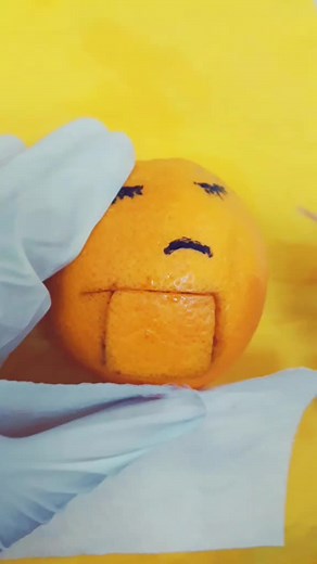 اطباء فاشلين😂💙#طبرق_الكبيدة #الوطن_العربي #ليبيا #تونس #libya #lola #tobruk