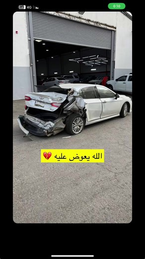 ‏كامري من اقوى الصدمات قبل وبعد ماشاء الله 🥺 رأيكمم ؟