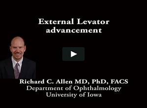 External levator advancement
