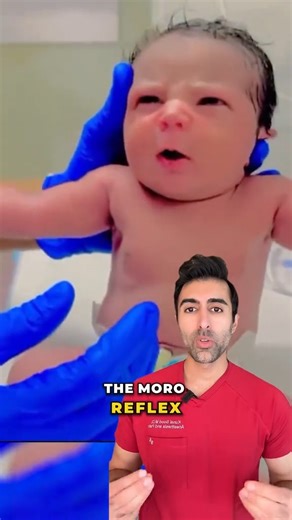 33K views · 344 reactions | The Moro reflex is a natural response that develops before birth, helping babies react to sudden changes in their environment. When startled, babies throw out their arms and legs before pulling them back in. Doctors check this reflex as a sign of healthy nervous system development. ✨ Have you ever seen a baby do this? VC: @cutebaby20232024 #health #medical #parentingtips #babyhealth | Kunal Sood, MD | Facebook