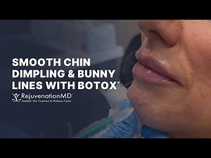 Botox for Chin Dimples and Bunny Lines