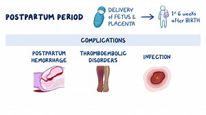 Video: Postpartum Complications - Video Explanation! | Osmosis | Osmosis