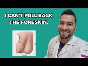I Have Phimosis: Can't Retract My Foreskin | Dr. David Campos