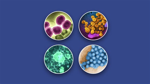 Are your symptoms the flu, COVID, RSV, norovirus? How to tell the difference