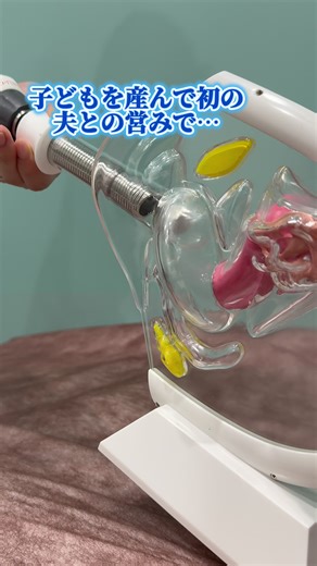 女性器形成とインティマレーザー治療の感想