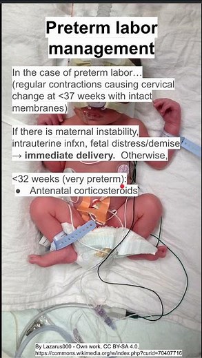 Preterm labor management