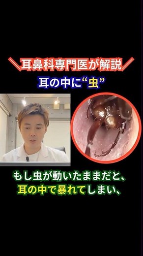 [An insect got into my ear] Actual response | Explained by an ENT doctor in Minato Ward and Nakag...