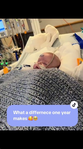 One year ago today our lives were very different. We left home again to head to Philadelphia. John needed open heart surgery at 4 months old. Each minute during this time felt like a lifetime. I felt like he would never smile again. The recovery was long and painful. To say I am proud of him is an understatement. He’s such a happy boy who is full of so much love and joy. ❤️ #heartmom #chdawarness #CHD #CHOP
