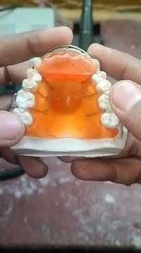 Dental Lab Work | Clear Retainer Step-by-Step