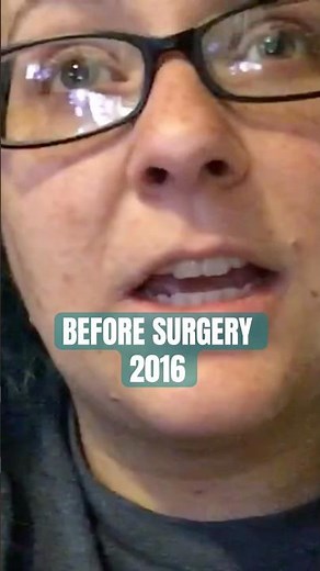 Weight loss journey through Roux En Y Gastric Bypass PT 1