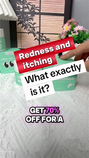 Red Patches and Itching on Inner Thighs Explained