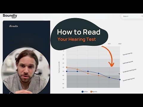 How to Read a Hearing Test | Common Configurations