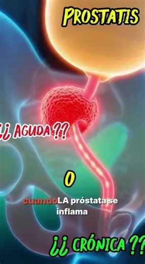 Prostatitis