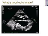 What is a Good Echo • Video • MEDtube.net