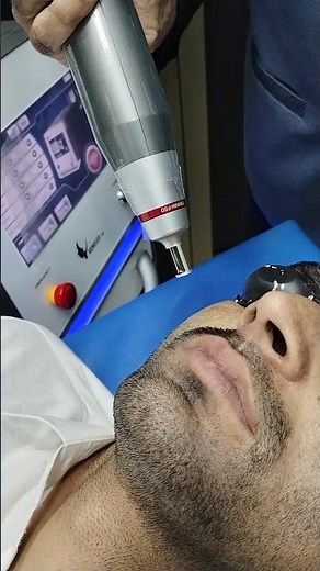 Q-Switch ND YAG Laser for Melasma | Best Laser Treatment for Dark Spots & Pigmentation #melasma