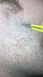 Beard pili multigemini 😍 | PickyNiki
