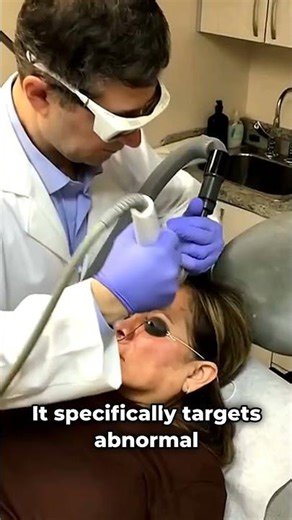 Cutera EXEL V Laser: Say Goodbye to Rosacea, Dyschromia & Uneven Skin Tone!