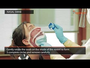 Rapid test for the detection of the SARS-COV-2 (COVID-19) antigen