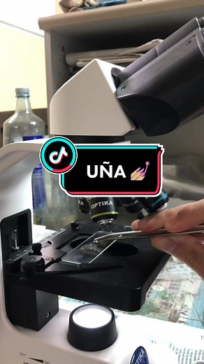 Uñas bajo el microscopio: descubriendo la suciedad