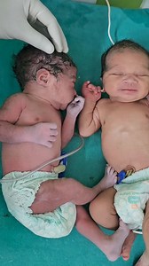 222K views · 3.1K reactions | 﫣 | Primary health care | Facebook