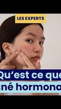 Qu'est ce que l'acné hormonale ?