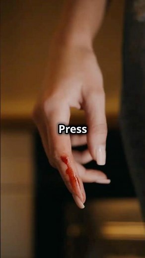 Emergency Steps for Hand Injuries: Stay Safe!