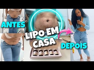 BEFORE AND AFTER AT-HOME HD LIPOSUCTION - HOW I LOST WEIGHT FAST - VLOG