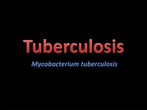 Tuberculosis - SlideServe