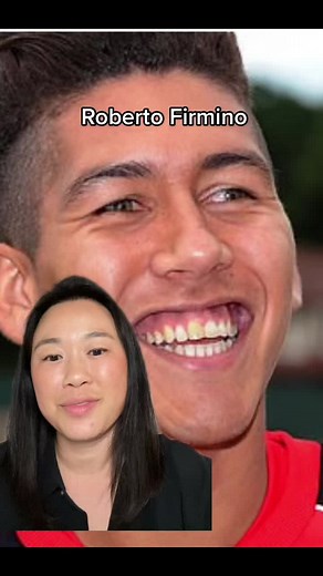 Smile Transformation: Roberto Firmino's Veneers Before & After