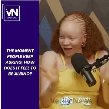 "The Moment People Keep Asking, 'How Does It Feel to Be Albino?