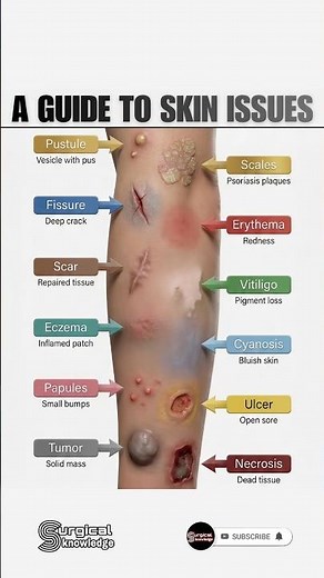 Skin Disease Identification Tutorial | Clear & Easy Explanation