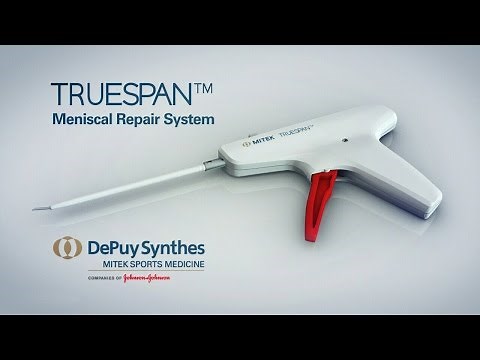TRUESPAN™ Meniscal Repair System