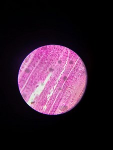 The Magical World under the Microscope | Medical Laboratory Scientist - MLS