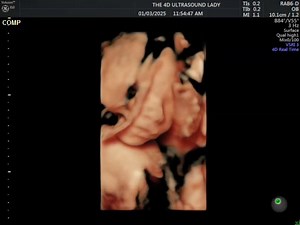 8.6K views · 474 reactions | 23 week old babe imaged in HD  | The 4D Ultrasound Lady | Facebook