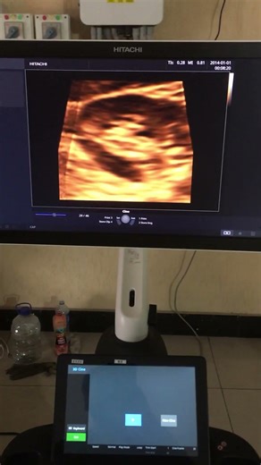Hitachi ultrasound japani available with convex 3D and 4D WhatsApp 03429053584