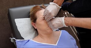 11K views · 237 reactions | Eye and Sinus Congestion, Deviated...