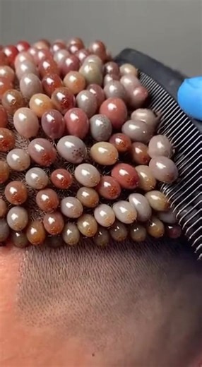 Understanding Trypophobia ASMR Effects